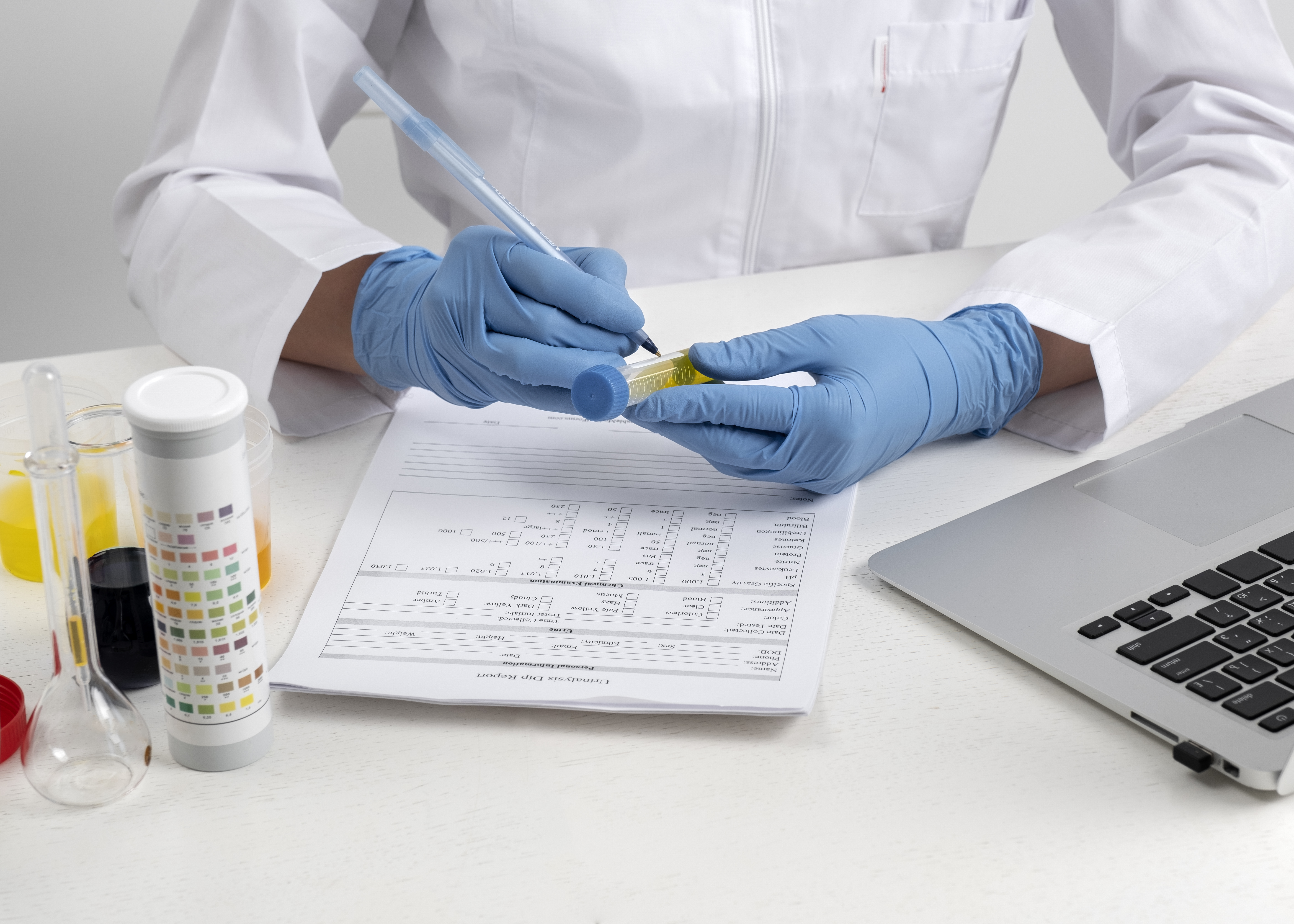 Hormone Test Kits